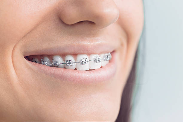 Dental Inlays and Onlays in Caruthersville, MO